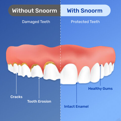 Snoorm image