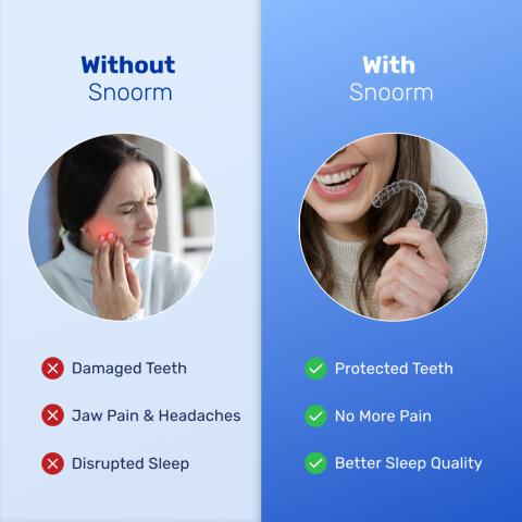 Snoorm image