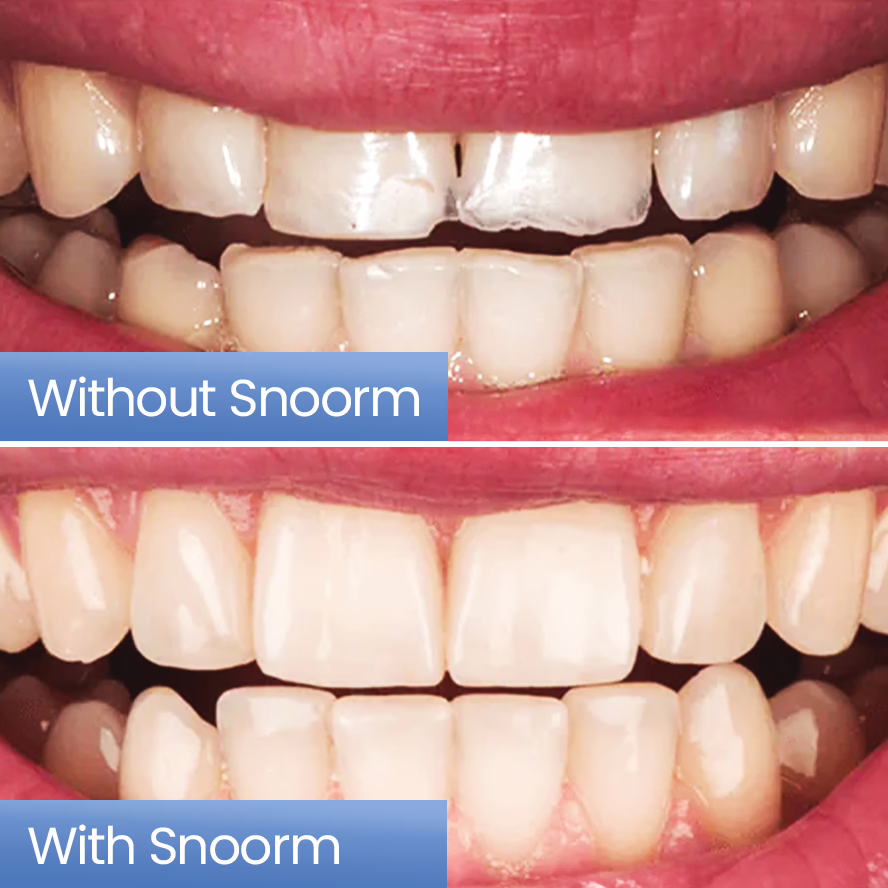 Snoorm image