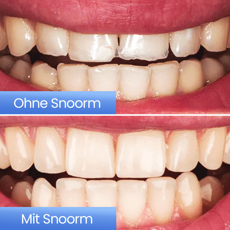 Snoorm image